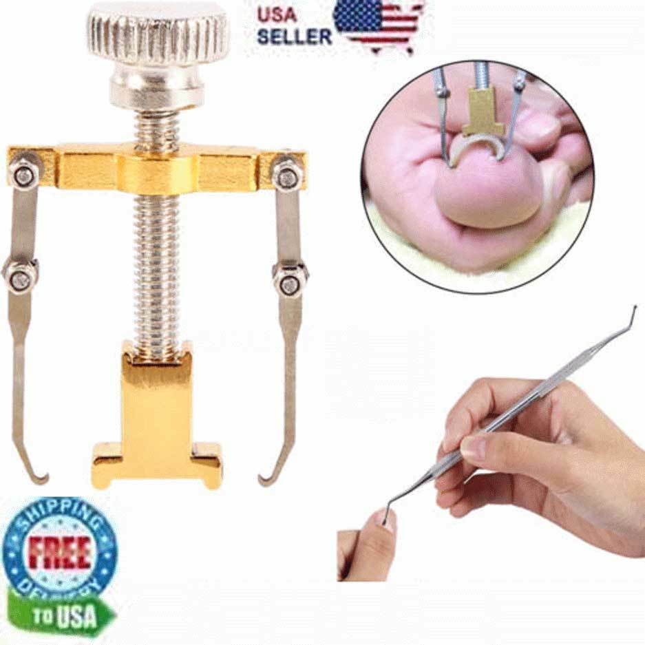 Ingrown Toe Nail Correction Lifter Tool Fixer Toenail Straightener Corrector Pro